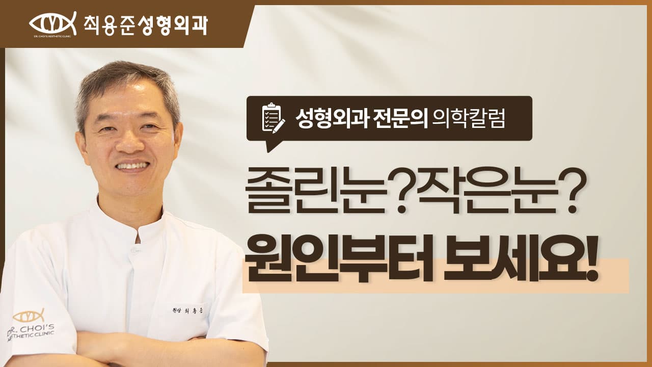 대구눈매교정? 눈이 작고 졸려 보인다면 '원인'부터 봐야 합니다.