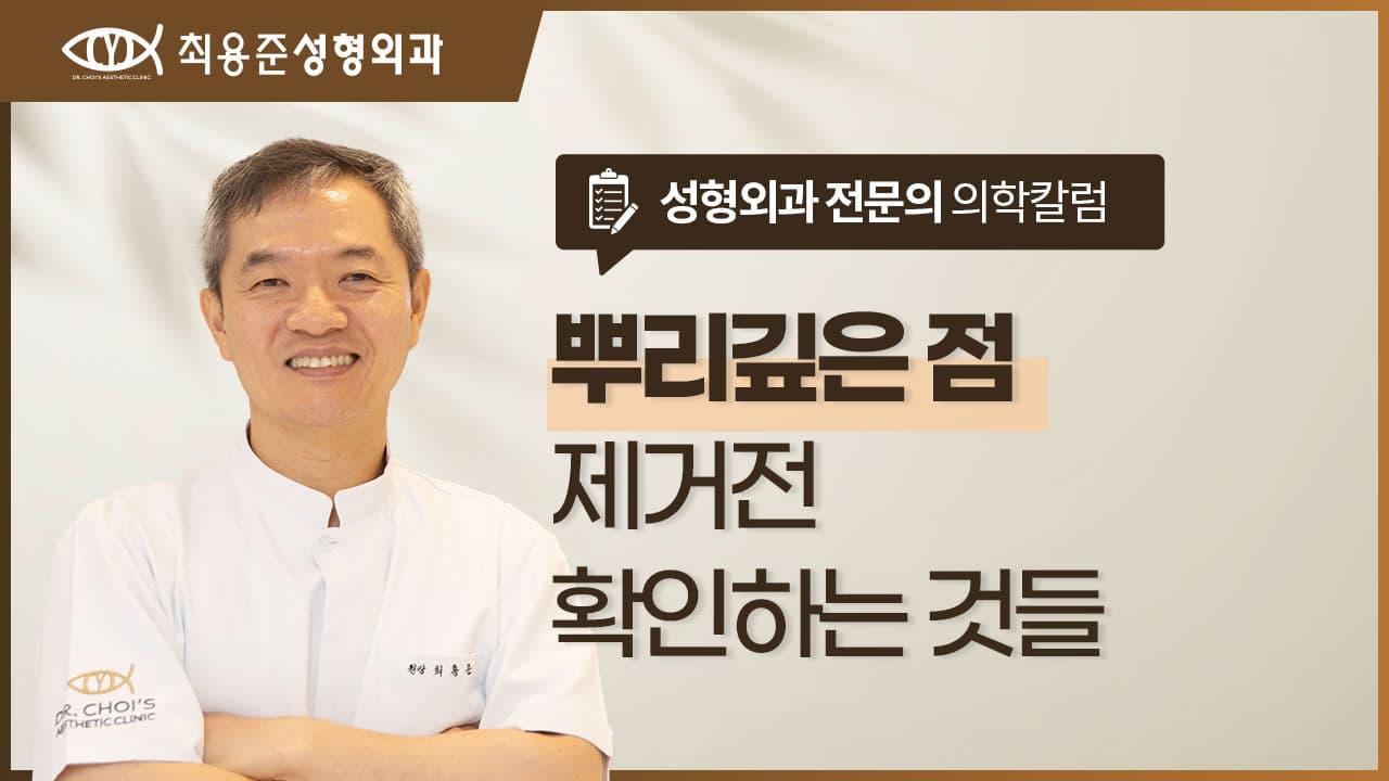 뿌리깊은점 제거 전 성형외과 전문의가 먼저 확인하는 것들